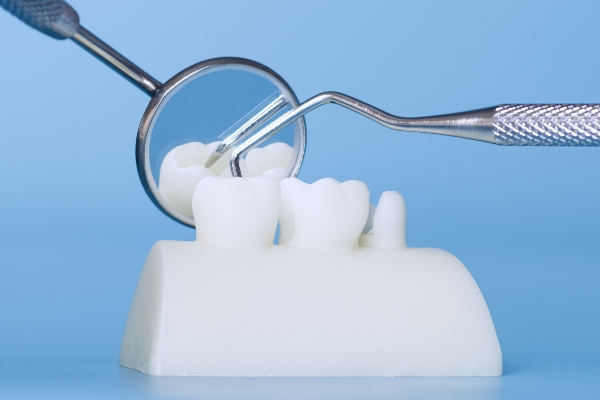 Caring For Dental Crowns: Tips To Extend Effectiveness And Longevity