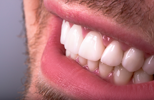 Tips To Help Dental Crowns Last Longer