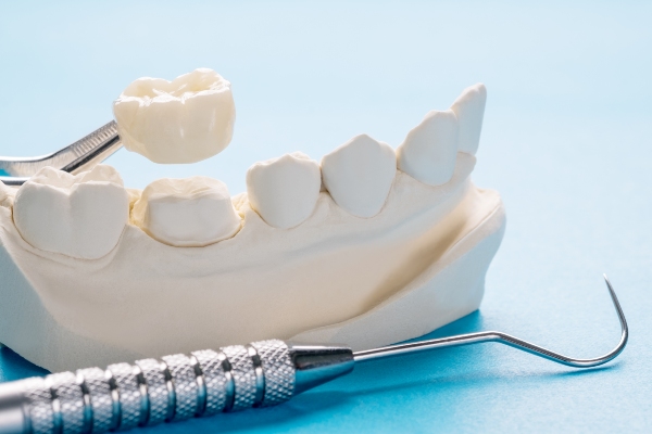 How Bruxism Can Affect Your Dental Crowns